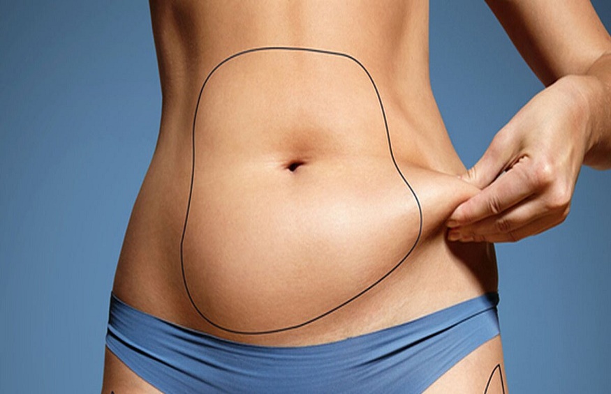 What is Actually CoolSculpting and how does it work?