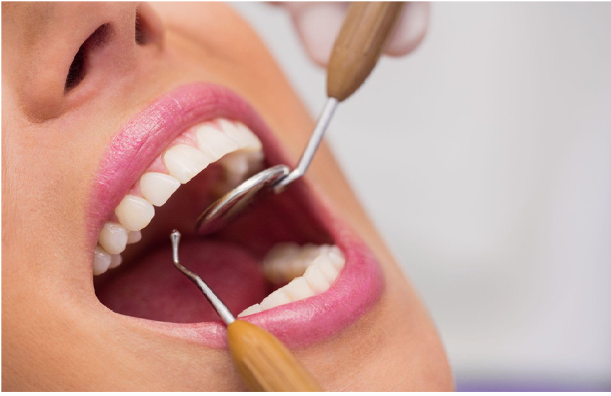 Important Strategies To Help You Prevent Tooth Decay and Keep Your Mouth Fresh