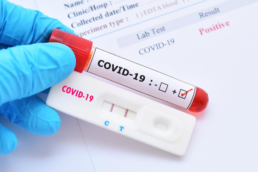 Reasons why should one opt for COVID testing services at home