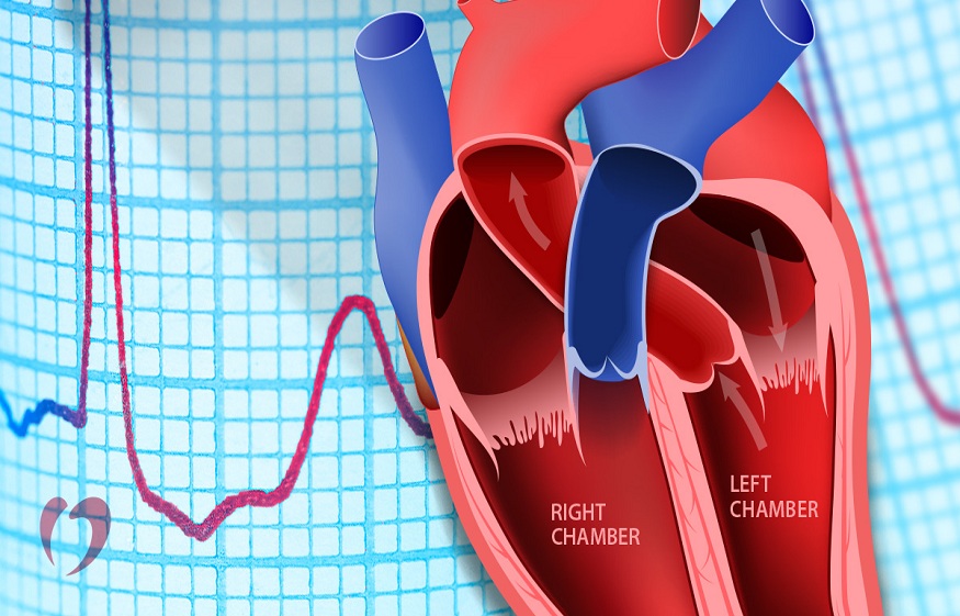 Heart Blocks: Types, Causes and Symptoms.