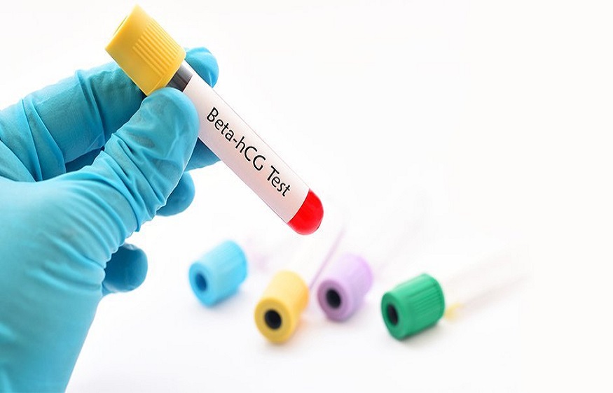 3 Advantages Of Blood Sample Collection Service At Home