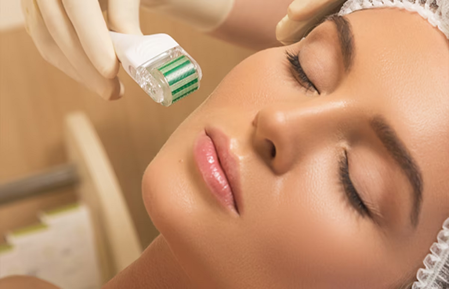 What You Should Know About Microneedling Treatment on the Face
