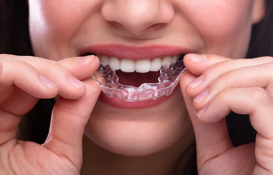 Causes of teeth grinding – How to stop it?