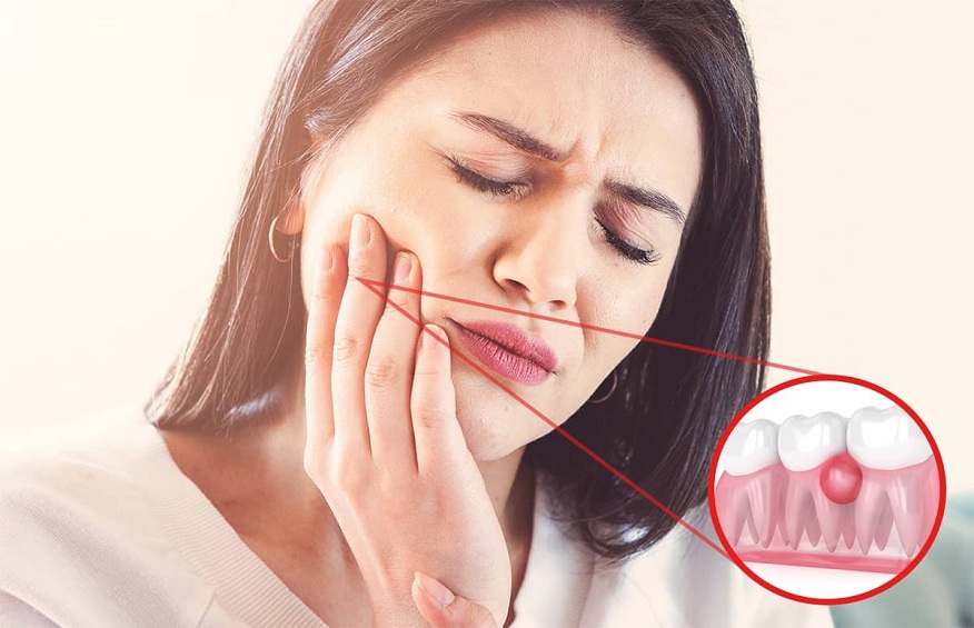 CRITICAL SIGNS YOU HAVE A DENTAL INFECTION AND SHOULD SEEK TREATMENT IMMEDIATELY