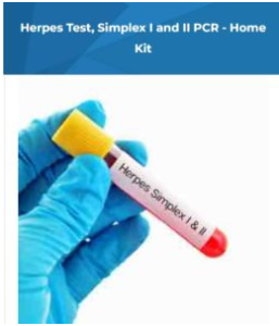Herpes Test London
