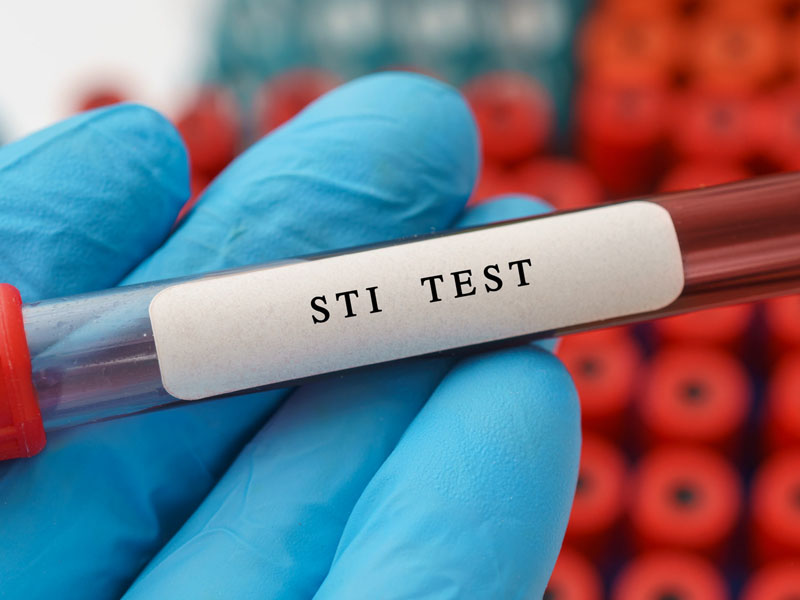 STI Test Made Influences on Human Life