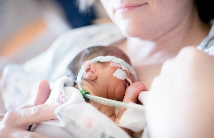 A Quick Guide to Premature Birth