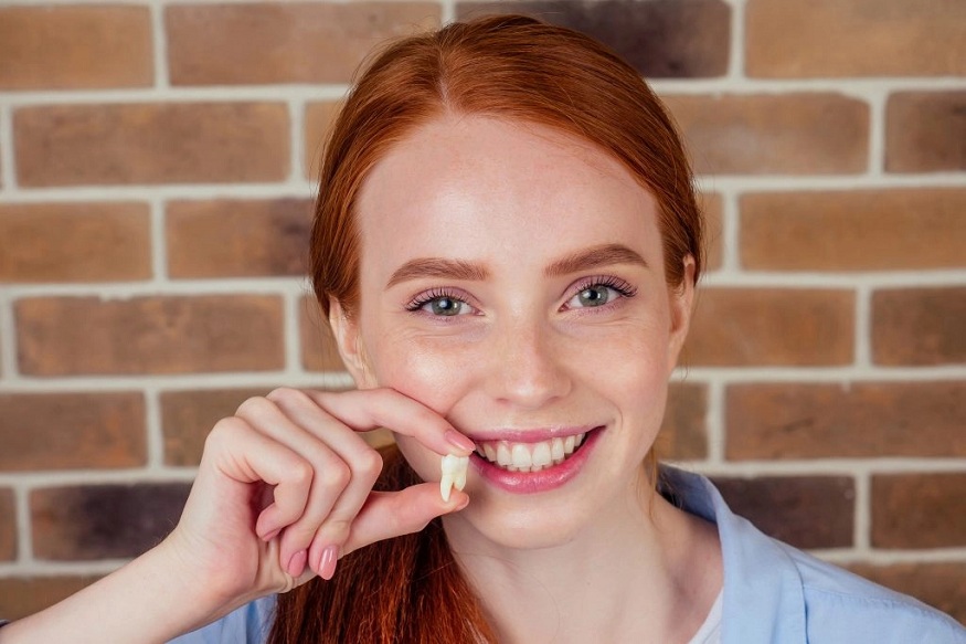 The Benefits of Early Wisdom Teeth Removal: Why Timing Is Key