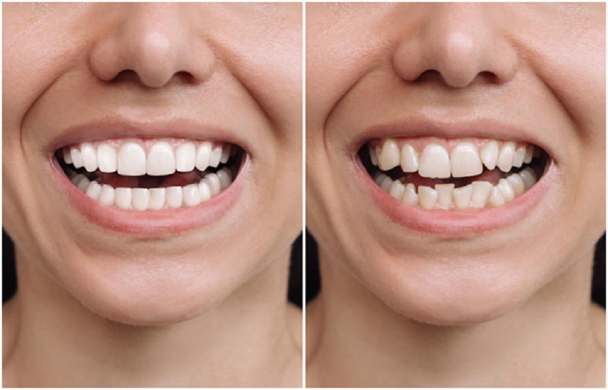 How Cosmetic Dentistry Helps Build Confidence and a Healthier Smile